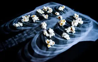 ریه پاپ‌کُرنی؛ بیماری خطرناکی که می‌تواند با کشیدن ویپ پدید آید