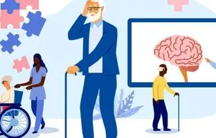 افراد در این مشاغل زودتر آلزایمر می‌گیرند