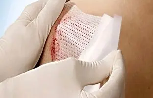 راه‌های بند آوردن خونریزی شدید
