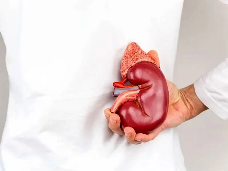 علائم رایج بیماری کلیوی کدام است؟ 