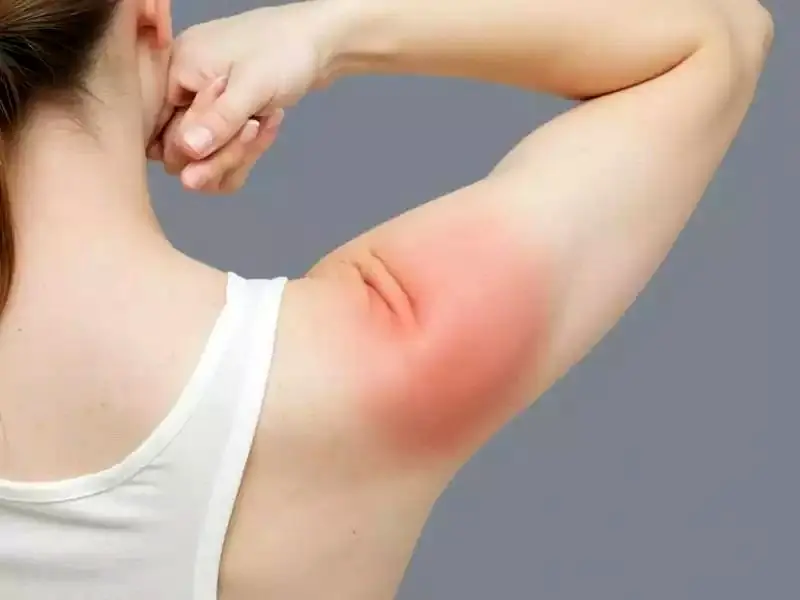 دلایل پارگی تاندون شانه چیست؟ + ویدئو