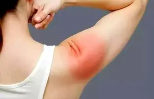دلایل پارگی تاندون شانه چیست؟ + ویدئو