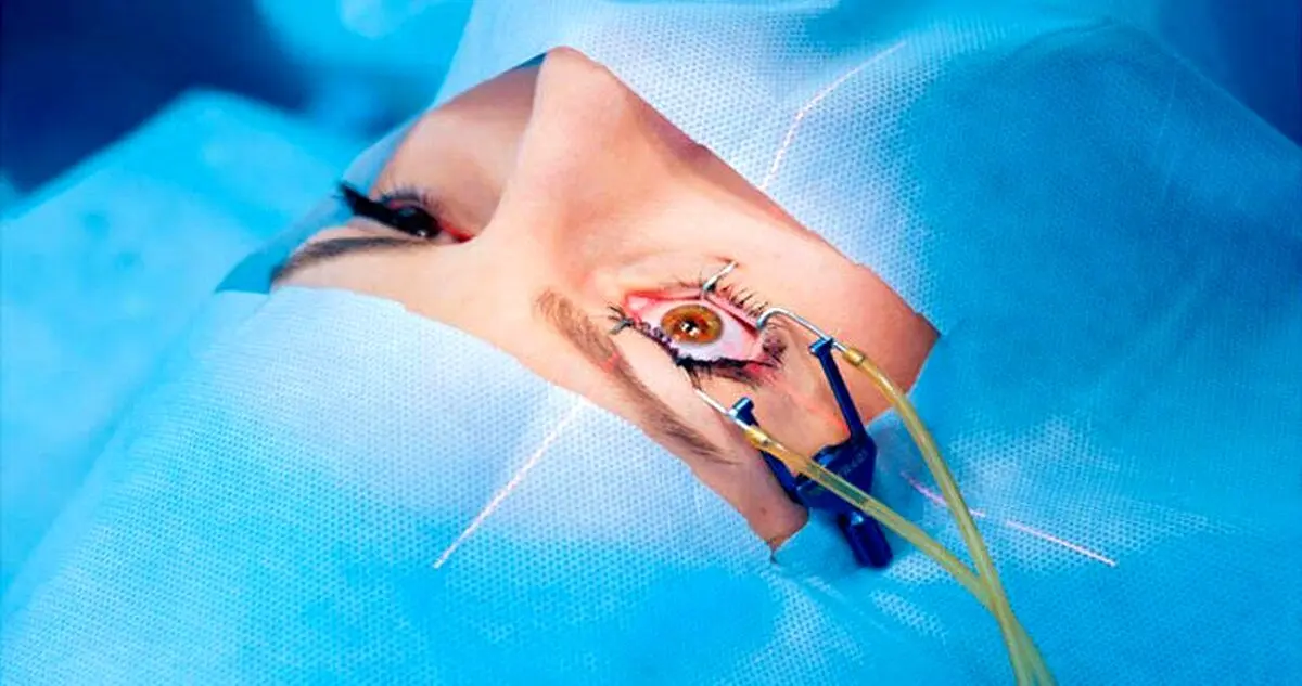 واکنش مجلس به ماجرای نابینایی ۹ بیمار در بیمارستان نگاه
