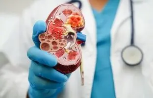 همه چیز درمورد سنگ کلیه