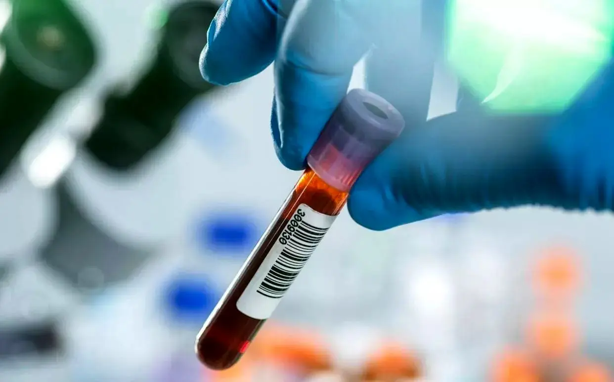  شناسایی سرطان 3 سال قبل از بروز با این آزمایش خون!