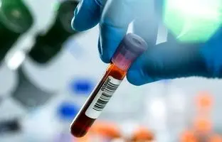  شناسایی سرطان 3 سال قبل از بروز با این آزمایش خون!