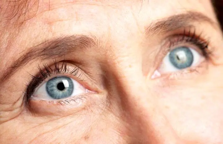 علایم پنهان آب مروارید که نباید آنها را نادیده گرفت