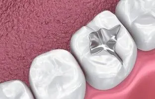 یک راه‌حل علمی برای محافظت از دندان مقابل نوشابه