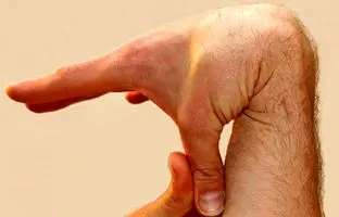 نرمی بیش از حد انگشت ها نشانه یک بیماری جدی است