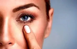 چرا زیر چشم سیاه و گود می‌شود؟ چگونه از آن جلوگیری کنیم؟