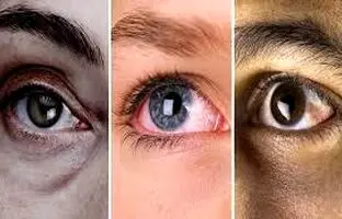 ۱۰ عادتی که سلامت چشمانتان را تضمین می‌کند