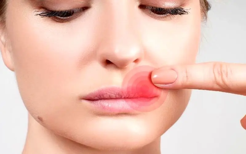 چرا بر روی لب تبخال می‌زنیم؟