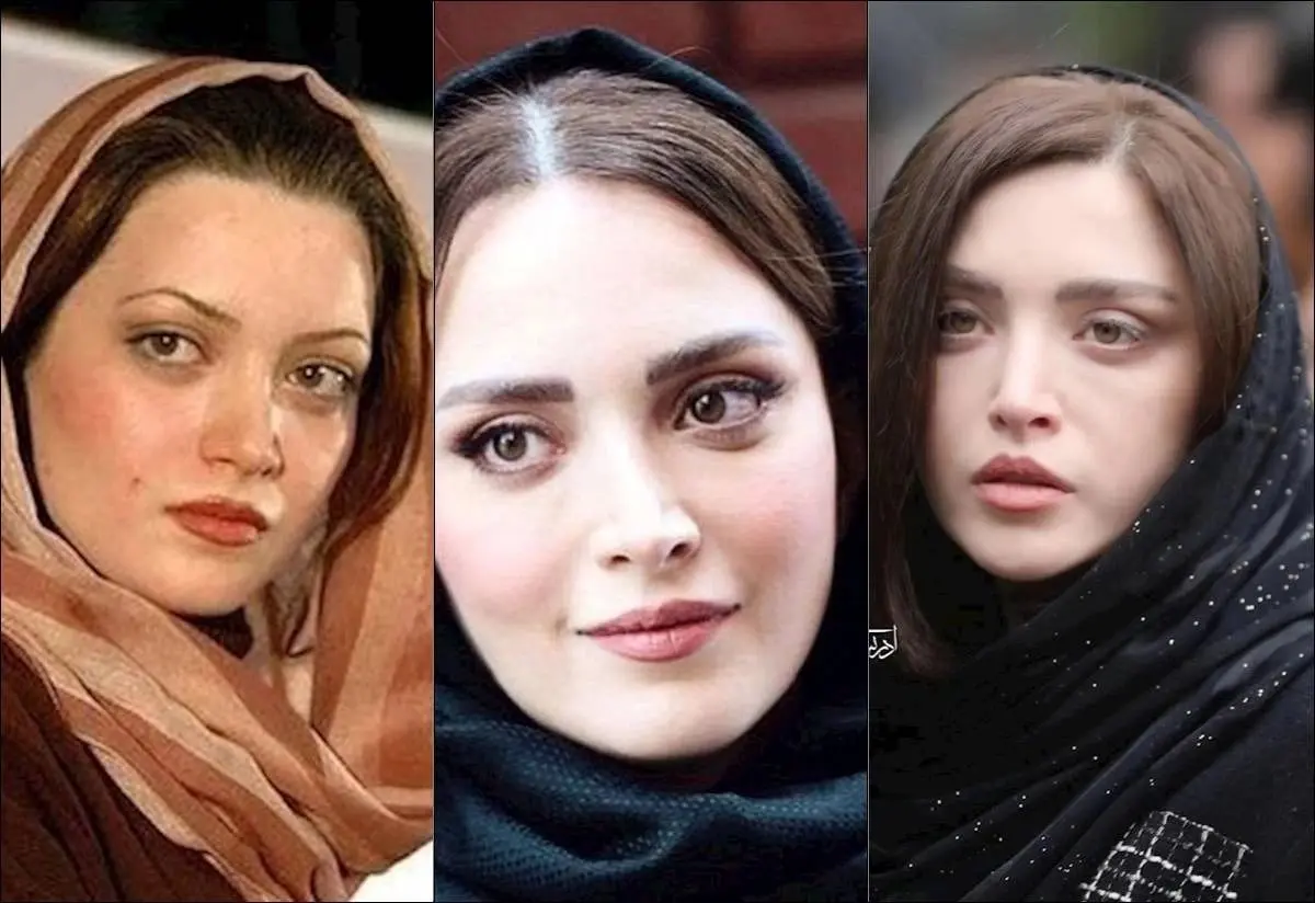  تغییر چهره «محمدرضا علیمردانی و بهنوش طباطبایی» در 48 و 43 سالگی + عکس