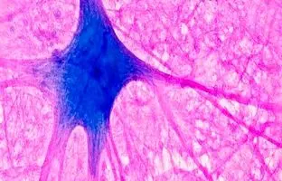 آیا ماده معروف شده در اینترنت واقعا برای مغز موثر است؟
