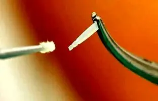 تولید ساختارهای پلیمری برای درمان ترمیمی دندان و عصب‌کشی