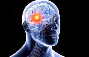 علائم هشدار دهنده تومور مغزی