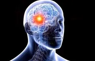علائم هشدار دهنده تومور مغزی