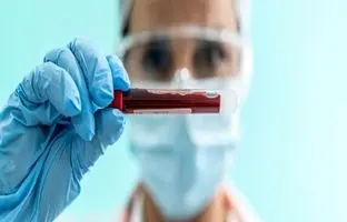 یک گروه خونی جدید و نادر کشف شد
