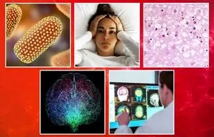 کُشنده‌ترین بیماری‌ها؛ از بی‌خوابی خانوادگی مرگ‌آور تا بیماری خنده