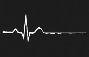 بدن انسان چگونه پس از مرگ فرو می‌پاشد؟ گزارش تصویری از یک فرآیند ترسناک + ویدئو