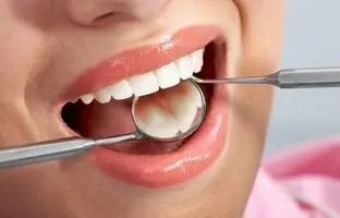 ۷ روش خانگی برای پاک کردن لکه های قهوه ای روی دندان