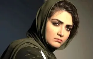  (تصاویر) تغییر چهره جذاب «سیما» سریال زخم کاری بعد 3 سال در 28 سالگی 