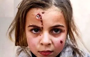 خونسردی عجیب دختربچه فلسطینی با ترکش در پیشانی + ویدئو