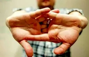 شکستن غیراصولی قولنج ممنوع + ویدئو