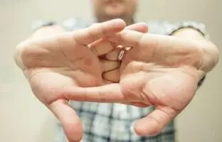 شکستن غیراصولی قولنج ممنوع + ویدئو