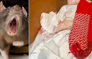  موش، انگشت پای یک پیرزن را جوید 