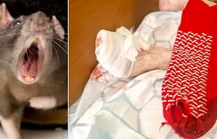  موش، انگشت پای یک پیرزن را جوید 