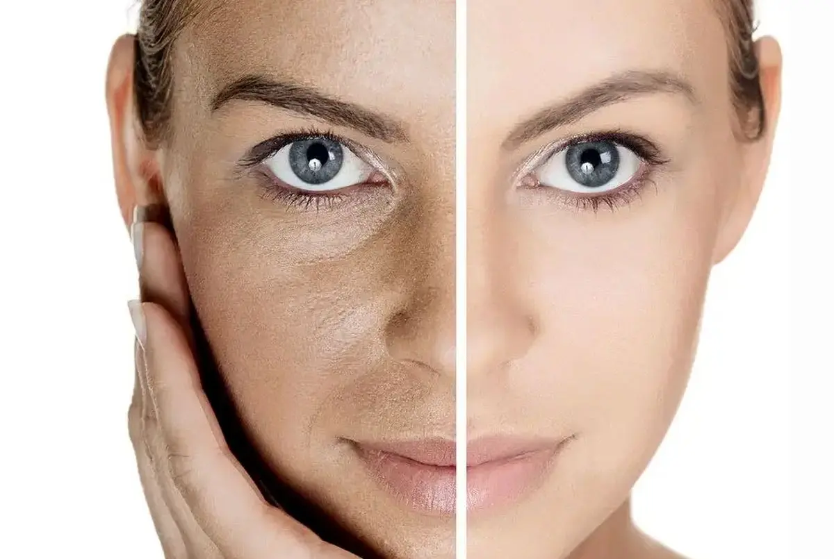 چهار مرحله برای مراقبت از پوست 