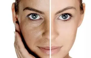 چهار مرحله برای مراقبت از پوست 