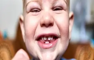 چرا قلقلک باعث خنده می‌شود؟