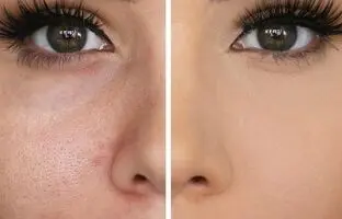بهترین کرم پودر برای منافذ باز پوست؛ راهنمای کامل برای پوستی بی‌نقص و صاف