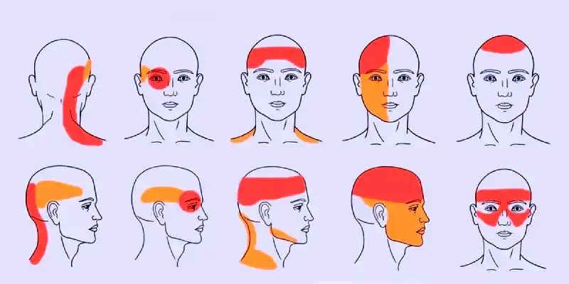 چگونه بدون قرص، از سردردهای تابستانی خلاص شویم؟ 