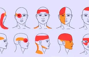 چگونه بدون قرص، از سردردهای تابستانی خلاص شویم؟ 