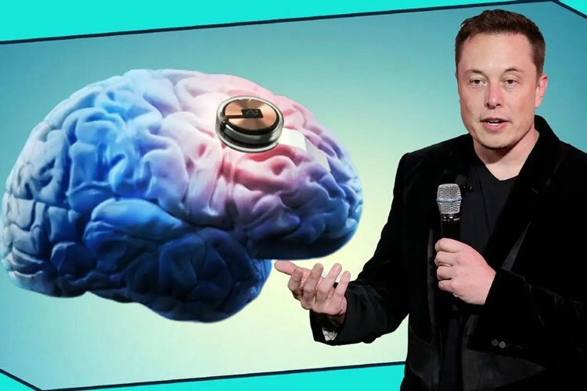 ایلان ماسک: با تراشه نورالینک مرگ دیگر معنایی ندارد 