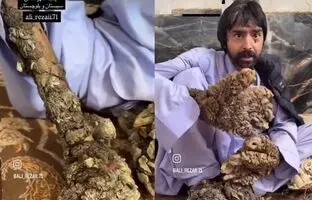 مرد درختی سیستان و بلوچستان را دریابید! + ویدئو