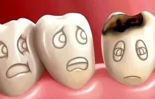 چرا دندان‌ها زود به زود پوسیده می‌شوند؟