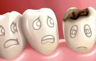 چرا دندان‌ها زود به زود پوسیده می‌شوند؟
