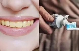 چرا دندان‌ ها زشت می‌ شود؟