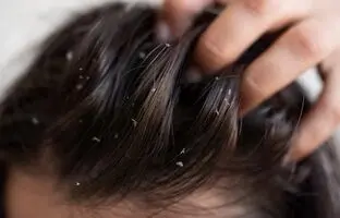 فقط بعد از یک روز، موهایتان چرب می شود؟ علت‌های اصلی که احتمالا نادیده می‌گیرید 