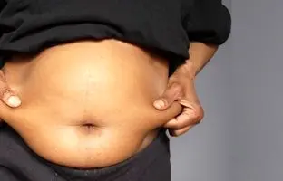 دلیل بزرگ شدن شکم با افزایش سن چیست؟