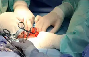  جراحی برای سنگ‌کلیه؛ آری یا خیر؟ + ویدئو