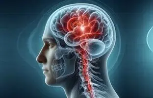 جدیدترین دستورالعمل‌ها برای پیشگیری از سکته مغزی اعلام شد