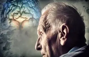  هوش مصنوعی یک علت جدید را برای آلزایمر کشف کرد 