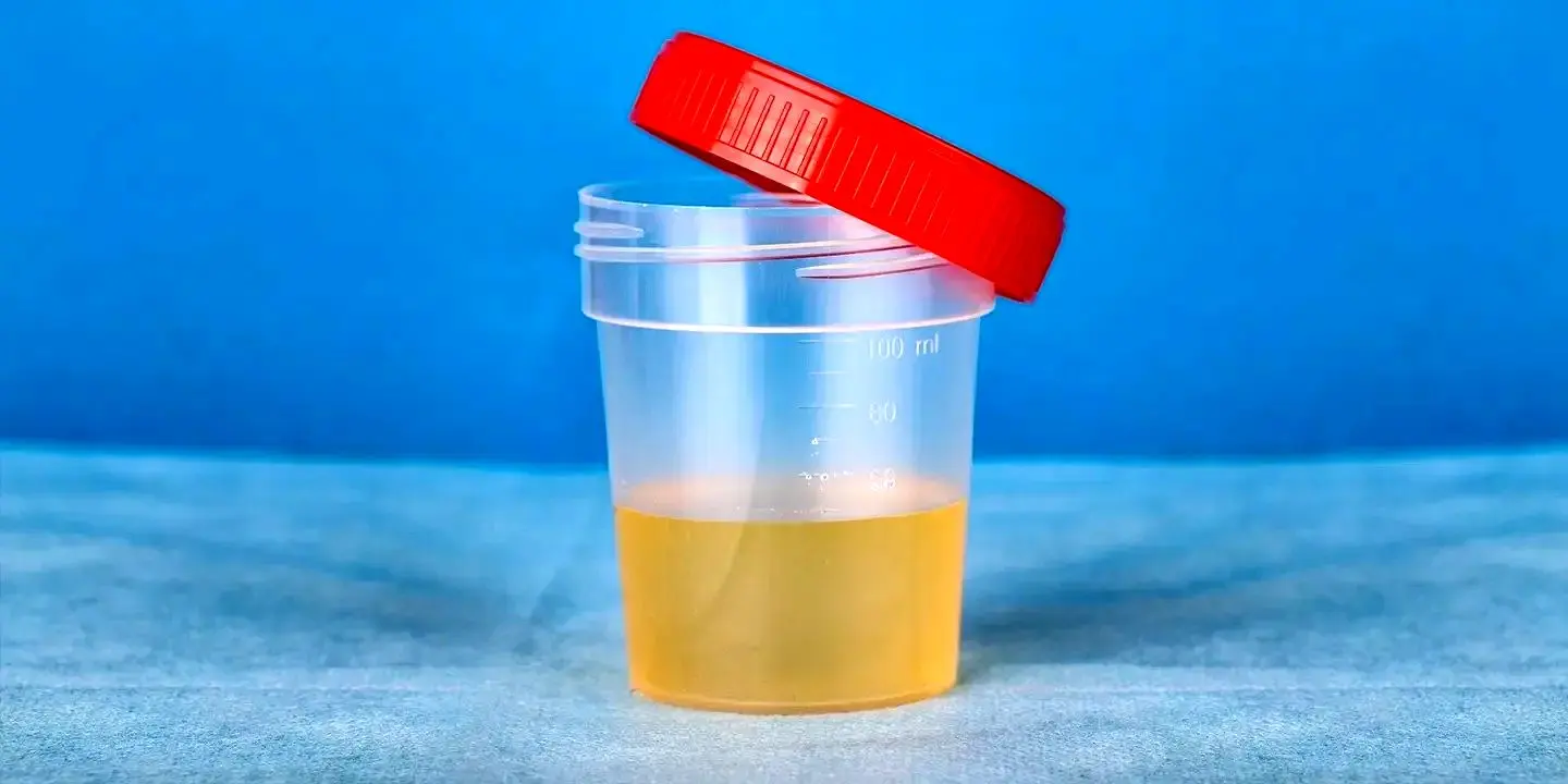 درباره ادرار حتما این حقایق مهم رو بدونید