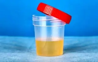 درباره ادرار حتما این حقایق مهم رو بدونید