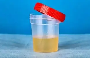 درباره ادرار حتما این حقایق مهم رو بدونید